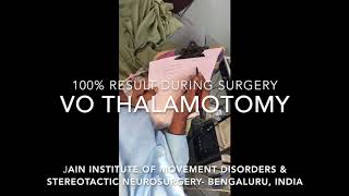 Writers cramp  Vo thalamotomy amp results during operation [upl. by Nissie240]