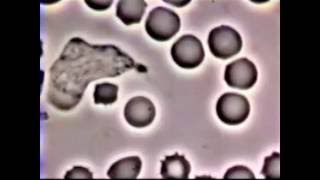 Neutrophil Phagocytosis  White Blood Cell vs Staphylococcus Aureus Bacteria [upl. by Stormy]