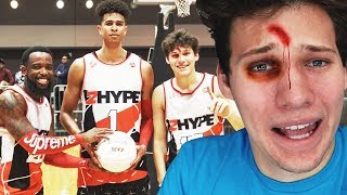 2HYPE FIRST OFFICIAL BASKETBALL GAME INJURY WARNING [upl. by Lona]