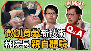 毛囊自體微移植技術 AMT，微創育髮治療雄性禿，林政賢院長親自體驗！楊省三醫師幫你解答 Regenera Activa RA 所有 Q amp A [upl. by Rhines]