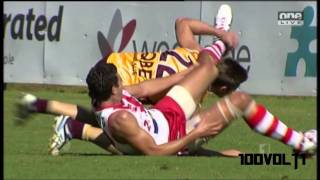 Jaymie Graham Former West Coast Player WORST leg break youll EVER SEE [upl. by Ynattyrb448]