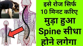 best stretches amp exercises for scoliosis S shape scoliosis exercises spine deformity physiotherapy [upl. by Assenad]