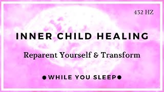 Inner Child Healing Affirmations  Reprogram Your Mind While You Sleep [upl. by Airoled]