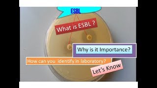 ESBL Extendedspectrum betalactamase  Escherichia coli [upl. by Clapp]