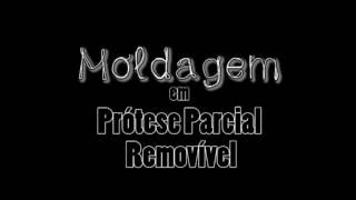 PPR Moldagem Anatômica para Modelo de Trabalho [upl. by Nomaid]