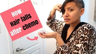 HOW and WHEN hair falls out post chemo [upl. by Ynavoeg]