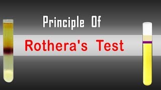 Principle Rotheras Test [upl. by Arytal]