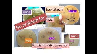 Betalactamase detectionESBL MBL KPC AmpC OxacillinaseMRSAD Zone test positive iMLSB strain [upl. by Noivad]