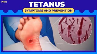 TETANUS causes symptoms and prevention [upl. by Eunice]