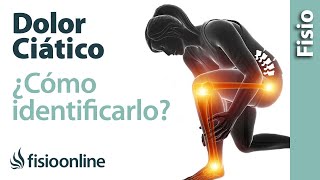 Cómo saber si tienes una CIÁTICA o dolor del nervio ciático [upl. by Yerffoej]