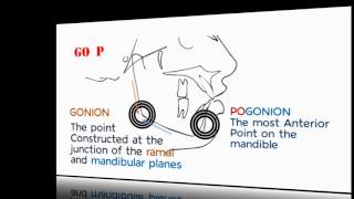 Cephalometrics Part II [upl. by Boutis]