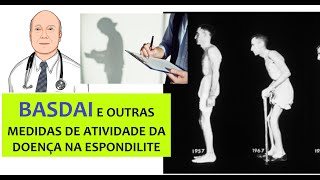 Métodos para aferir resposta ao tratamento na espondilite anquilosante BASDAI e outros testes [upl. by Naivaj]