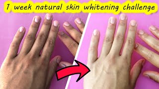 How to make hands white at home naturally  skin whitening home remedies  fair skin  Sajal Malik [upl. by Acemahs]