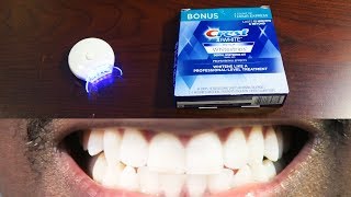 How To Whiten Teeth Easy • AuraGlow LED Light amp Crest 3D Whitestrips [upl. by Berthoud640]