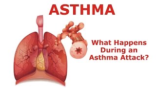 Asthma Explained Clearly Asthma Symptoms and Diagnosis [upl. by Geerts576]