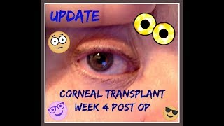 UPDATE Corneal Transplant Week 4 Post Op [upl. by Telimay]