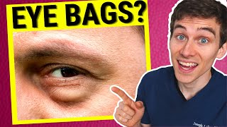 Eye Doctor Explains How to Get Rid of Under EYE BAGS [upl. by Reema698]