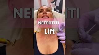 A Nefertiti lift using Botox botox lift necklines nefertiti aesthetics medspa antiaging [upl. by Niles]