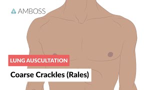 Coarse Crackles Rales  Lung Auscultation  Episode 3 [upl. by Gale]