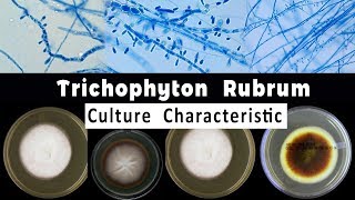 Trichophyton Rubrum culture Characteristic [upl. by Nurav416]