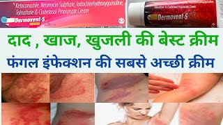 dad ki acchi cream ।। khujli ki cream।। fungal infection ki cream।। dermovent 5 use in hindi [upl. by Elva774]