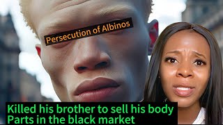 The Killing and Persecution of Albinos in Eastern Africa A True Story [upl. by Rese]