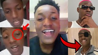 Ruger REAL FACE Without EYE PATCH Finally Revealed in Freestyle Video of Ruger Singing Davido Song😱 [upl. by Atiugram904]