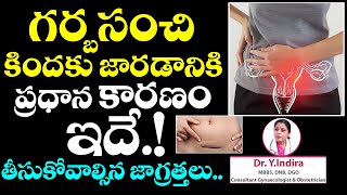 Prolapsed Uterus reasons and treatment to be taken  Dr Y Indira  TX Hospitals [upl. by Pembrook]