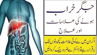 Jigar ki kharabi ki Alamat or ilaj  8 Signs of liver failure  Jigar ki garmi ka ilaj [upl. by Aleahpar]