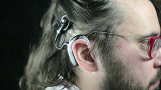 Dales journey with a cochlear implant [upl. by Enyrehtac]