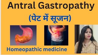 Antral Gastropathy पेट में सूजन treatment  Antral gastritis symptomscause amp homeopathic medicine [upl. by Annahaj]