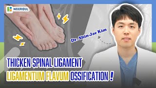 ligamentum flavum ossification [upl. by Rozamond626]