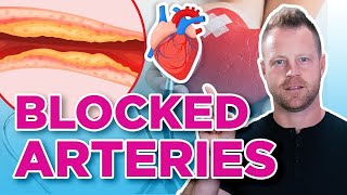 How To Prevent and Reverse Clogged Arteries  Heart Attacks [upl. by Ziagos]