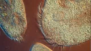 One Drop of Water Amazing High Definition Microscopy Video 1080P [upl. by Simmons594]