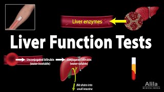 ULTRASOUNDGUIDED LIVER BIOPSY [upl. by Aramahs742]