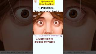 Symptoms of hyperthyroidism  hyperthyroidism ke lakshan  shorts shortfeeds [upl. by Poler]