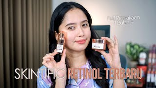 Review Retinol SKINTIFIC selama 1 BULAN   SKINTIFIC Retinol Skin Renewal [upl. by Bergh]