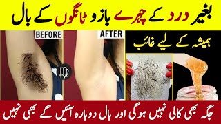 Remove Unwanted Facial Hair At Home  Permanent Hair Removal Home Remedy  Painless Hair Removal [upl. by Yruama]