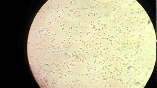 Sperm cells in microscope [upl. by Giuditta]