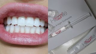 Hi Smile Teeth Whitening amp Toothpaste Review [upl. by Normac]