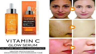 me on vitamin c glow serum  glow skin ke liye Best serum llk5ll viralvideo [upl. by Elleinod]