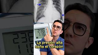 ¡Mucho cuidado La presión alta daña el corazón medicina shorts [upl. by Ecinrahs]