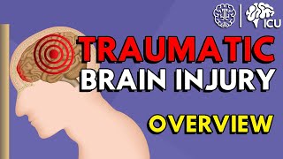 Overview of Traumatic Brain Injury TBI [upl. by Averil]