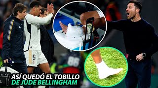 Así FUE el MOMENTO EXACTO de la LESIÓN de TOBILLO de BELLINGHAM  BRUTAL GESTO de XABI [upl. by Neladgam]