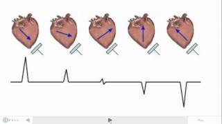 ECG and Electric Dipoles [upl. by Lowson]