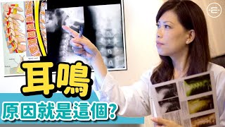 脊醫王鳳恩 耳鳴 原因就是這個 What is the cause of Tinnitus Dr Matty Wong Doctor of Chiropractic [upl. by Narol33]