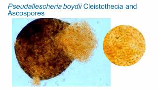 Identification of Melanized Dermatitiaceous Fungi Part 3 Hot Topic [upl. by Navad]