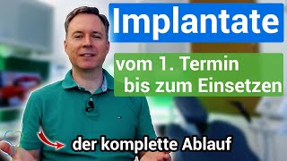 Zahnimplantate vom 1 Termin bis zur Fertigstellung kompletter Ablauf [upl. by Niltac]