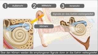 Wie das Gehör und das Hören mit einem CochleaImplantat funktioniert [upl. by Epilif]