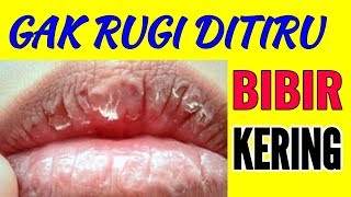 CARA MUDAH MENGATASI BIBIR KERING100  AJAIB [upl. by Irallih832]